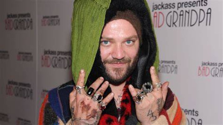 
All allegations against Bam Margera explained 