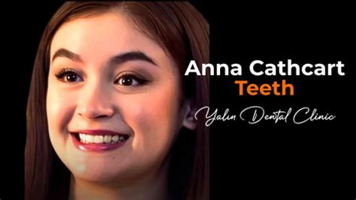 Anna Cathcart Missing Teeth Theory Debunked