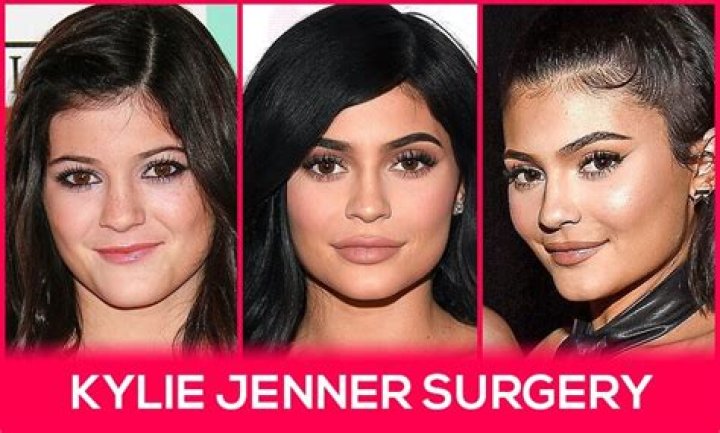 Kylie Jenner slams plastic surgery rumors